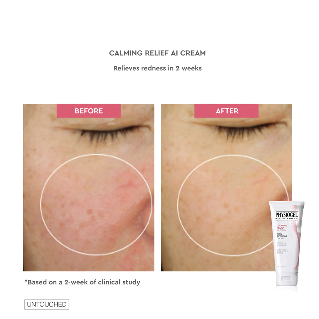Calming Relief AI Cream