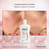 Calming Relief AI Lotion